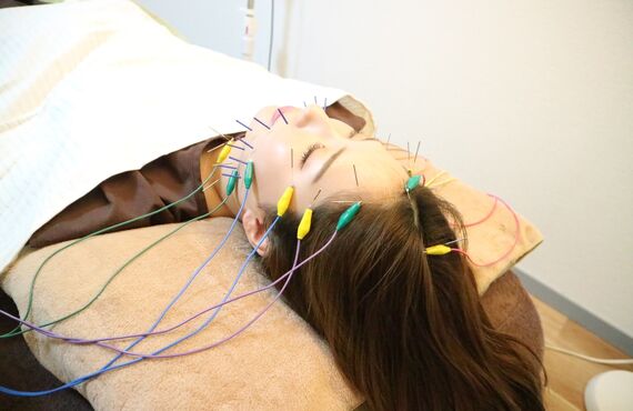 美容鍼で身体の内側から綺麗に| 体の内側から美しくなれる本八幡のサロン・mimosa/ミモザ